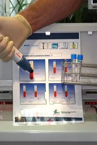 Dentista Monaco: fattori di crescita da componenti del sangue per supportare la guarigione implantare
