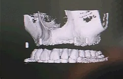 Munich dentist: historical high-tech developments Munich dentist: high-tech overview for patients