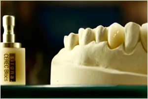 Aesthetic zirconia restorations