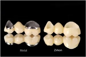High-strength zirconia dental restorations