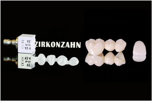 Munich archive: zirconia crowns and bridges, glass ceramic and metal-free restorations Munich archive: zirconia crowns and bridges, glass ceramic and metal-free restorations