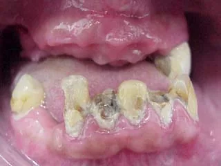 Munich dentist: shame does not help solve dental problems