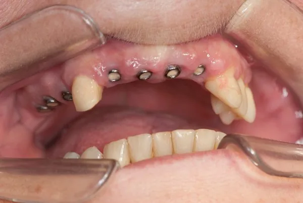 Dental prosthetics from the former Munich practice with in-house dental laboratory