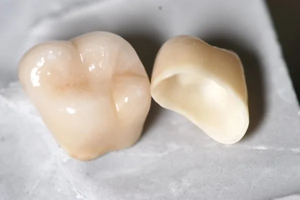 Munich: zirconia crown, Cercon, CAD/CAM, zirconium