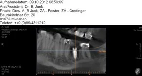 Radiologia dentale a dose ottimizzata