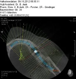 PAX Duo CBCT: apparecchiatura storica della pratica di Monaco