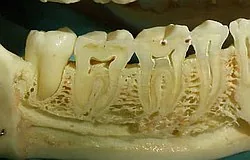 Munich dentist: why a non-vital tooth can be painful Munich dentist: why a non-vital tooth can be painful