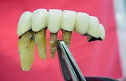Munich dentist: gum pain or toothache Munich dentist: gum pain or toothache